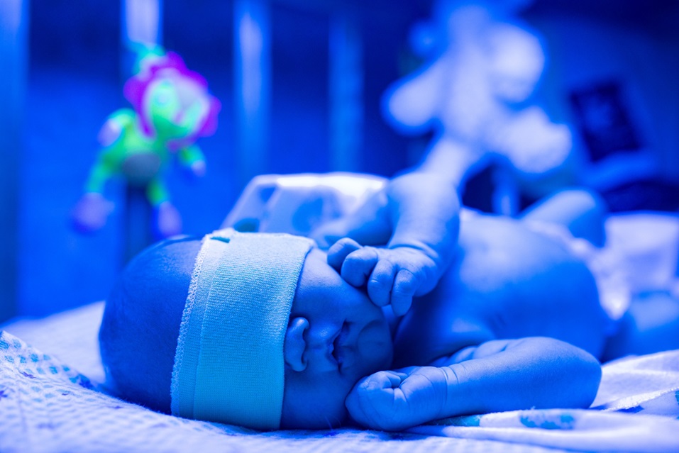Newborn having a treatment for jaundice under ultraviolet lamp in home bed