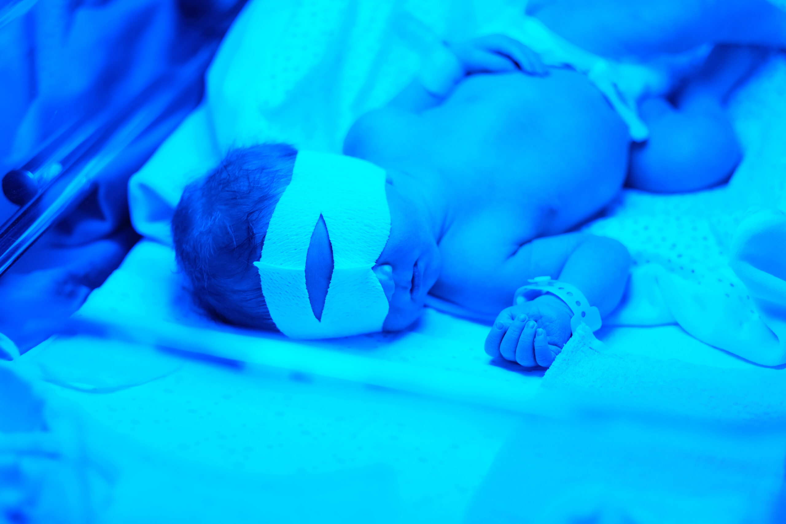 Newborn baby having photo theraphy
